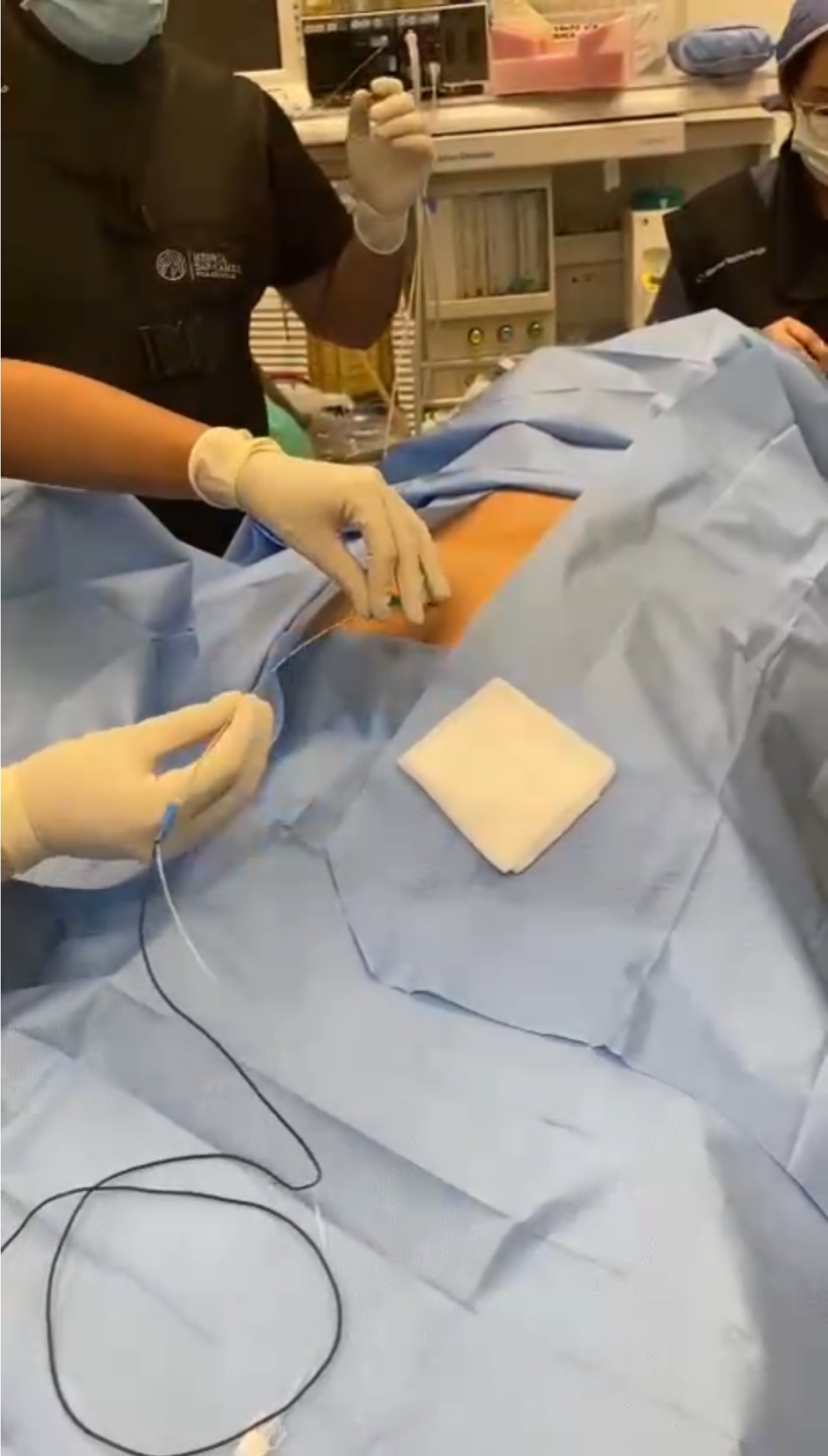 O cateter RF AXON e MedGs revoluciona a cirurgia minimamente invasiva 1